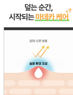Dongkook Madeca Hydrocolloid Band Medi Patch Free-Cut (2 Sheets x 10 Packs) image 6