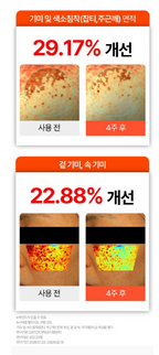 Siaren Melacid Cream 12X Dark Spot Hyperpigmentation Cream with Niacinamide & Tranexamic Acid, 100g, 3 Count image 3