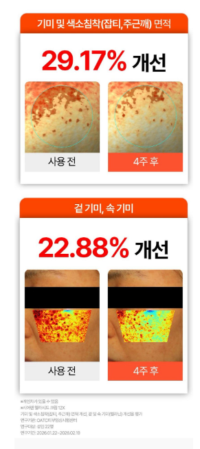 Siaren Melacid Cream 12X Dark Spot Hyperpigmentation Cream with Niacinamide & Tranexamic Acid, 100g, 3 Count image 3